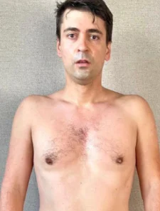 Weight Loss: 6kg — after